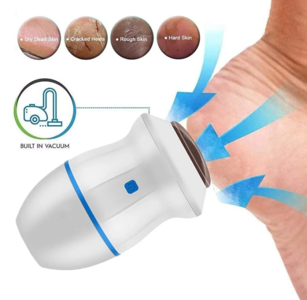 electric foot callus remover